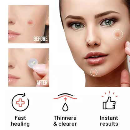 Chin Acne Day &amp; Night Repair Patch